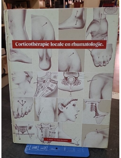 Corticotherapie Locale En Rhumatologie - A. Denis & M. Froin-Dencausse