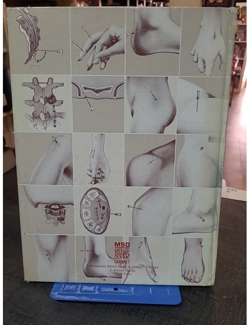 Corticotherapie Locale En Rhumatologie - A. Denis & M. Froin-Dencausse
