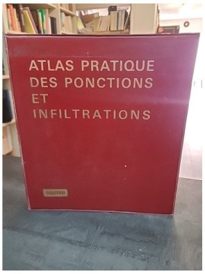 Atlas Pratique des Ponctions et Infiltrations : un guide de médecine par Squibb