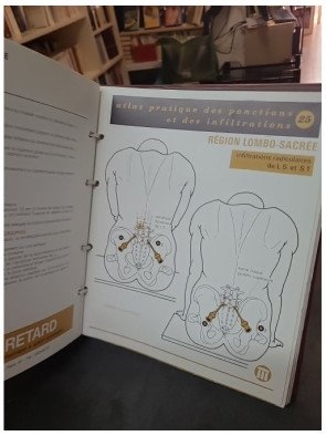 Atlas Pratique des Ponctions et Infiltrations : un guide de médecine par Squibb