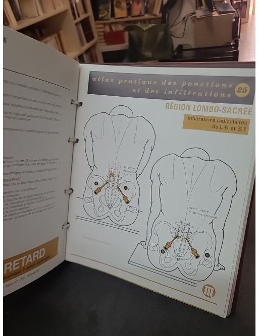 Atlas Pratique des Ponctions et Infiltrations : un guide de médecine par Squibb