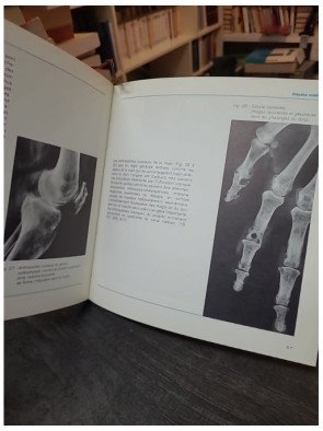 La Goutte par A. Ryckeweart et al. : ouvrage du Laboratoire Wellcome