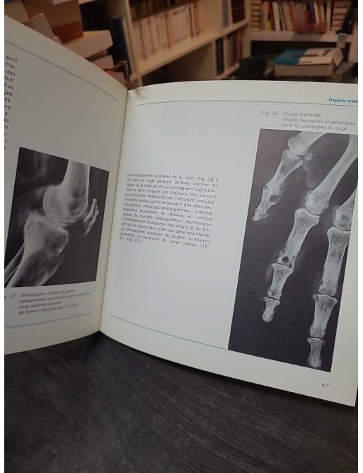 La Goutte par A. Ryckeweart et al. : ouvrage du Laboratoire Wellcome