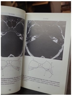 Imagerie de l'œil, de l'oreille et du cerveau par Georges Salamon