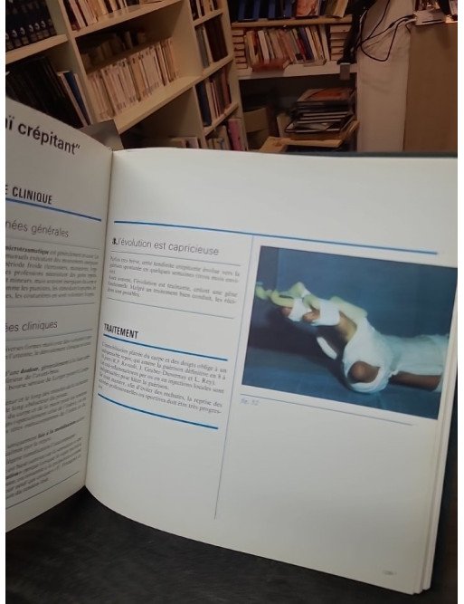 Pathologie abarticulaire diprostene - Francisque Commandre