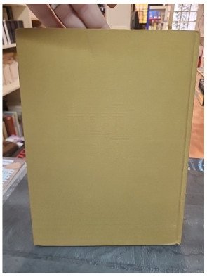 Spondylarthrite ankylosante : aspects cliniques et thérapeutiques