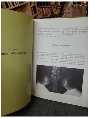 Spondylarthrite ankylosante : aspects cliniques et thérapeutiques
