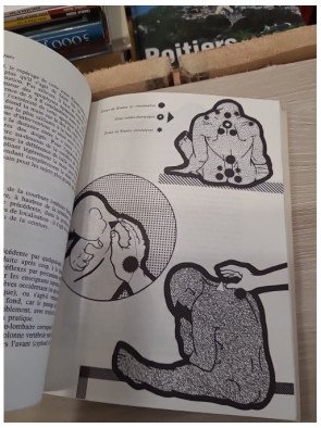 Kuatsu de réanimation, traitements traditionnels asiatiques des syncopes