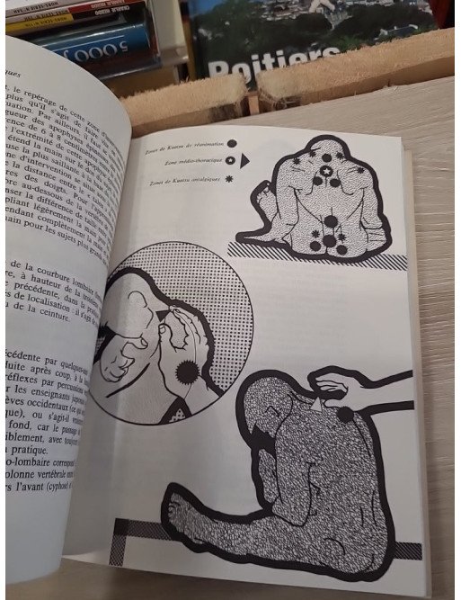 Kuatsu de réanimation, traitements traditionnels asiatiques des syncopes